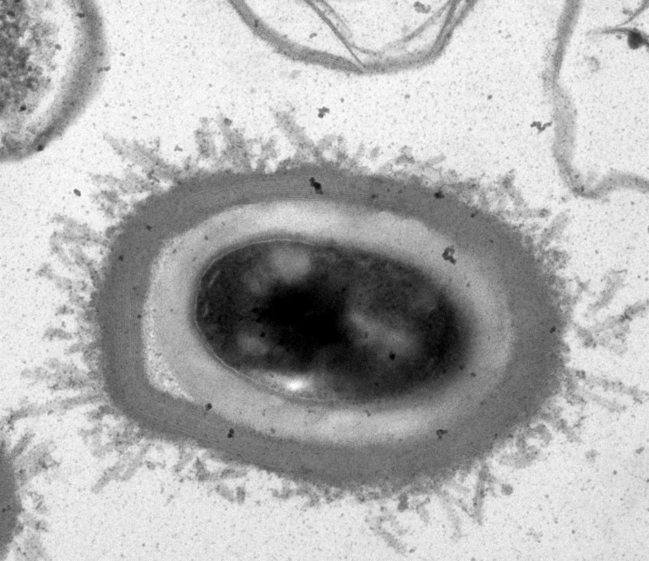 Clostridioides difficile