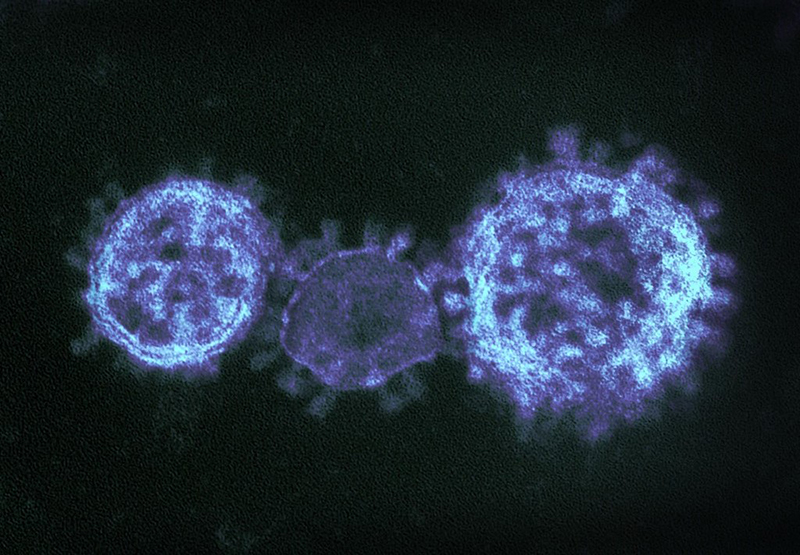 Coronaviruses