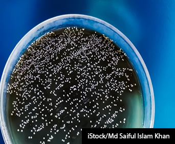 Colonies of Candida on agar media plate.