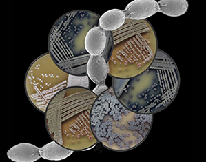 Streptomyces