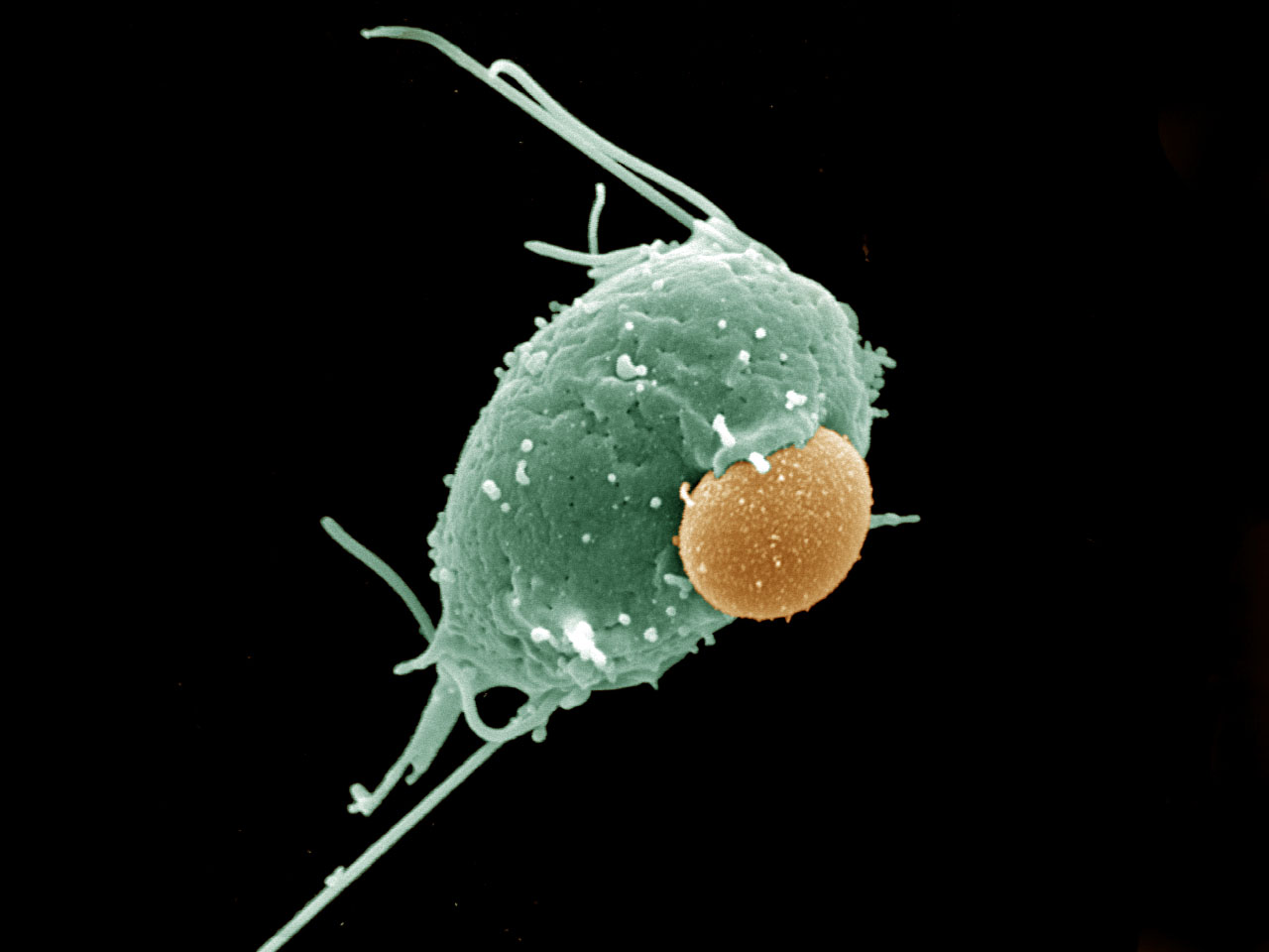 Trichomonads across space and time: multidisciplinary perspectives on a fascinating and ubiquitous group of microbial eukaryotes of medical, veterinary, and environmental importance.