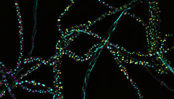 Understanding bacteria and challenges in microbiology